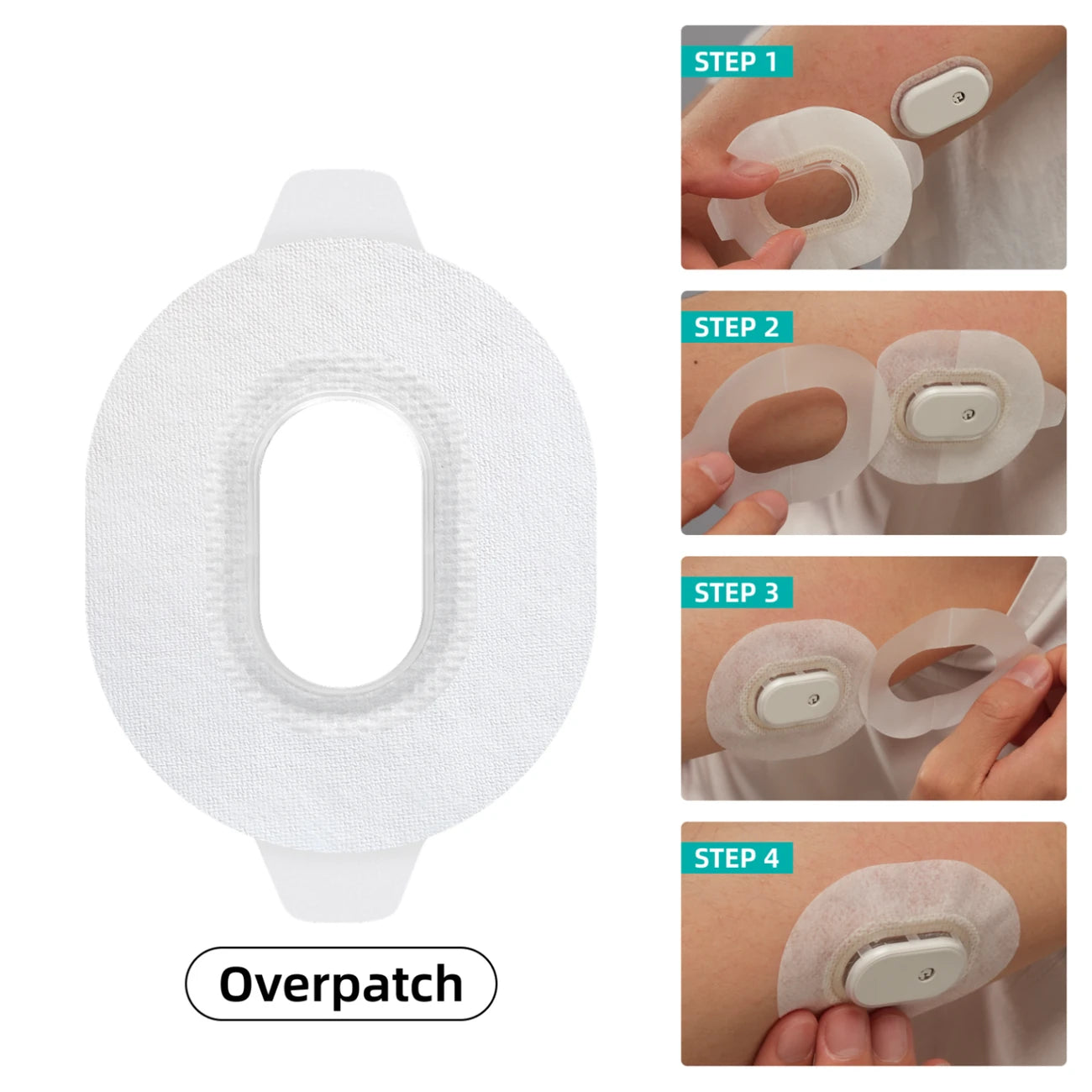 GS1 overpatch and the four application steps